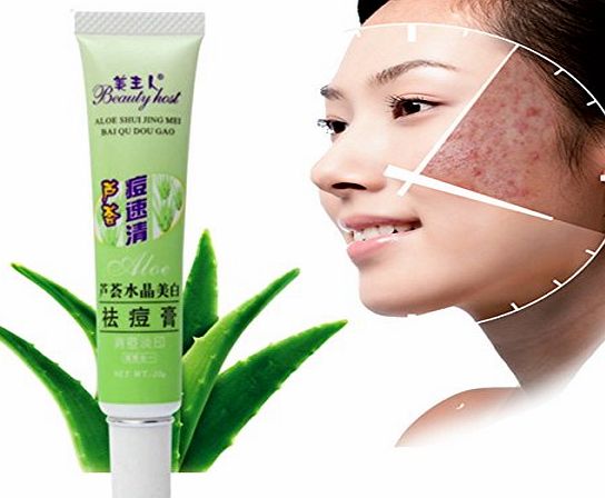 LuckyFine Acne Remove Anti-acne Scar Blemish Face Skin Care Treatment Aloe Vera Gel